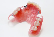 エステショット