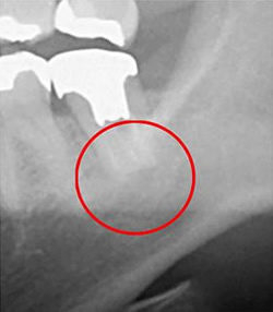 マイクロスコープ